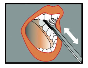 Brush the inside of your front teeth with the end of the brush.